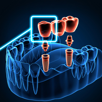 Новые технологии в стоматологии: о каких инновациях вы еще не слышали
